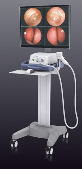 Видеооториноларингоскоп Dr. Camscope DCS-104T
